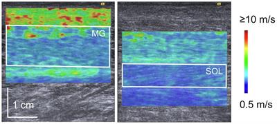 Relationship Between Drop Jump Training–Induced Changes in Passive Plantar Flexor Stiffness and Explosive Performance